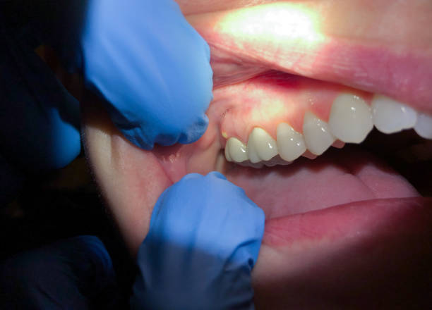 Best Emergency Treatment for Jaw Pain or Injury in Largo, MD